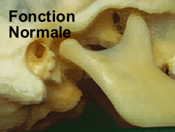 articulation mandibule crâne A T M , sans acouphène